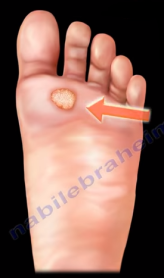 Big Toe Pain - Everything You Need To Know - Dr. Nabil Ebraheim 